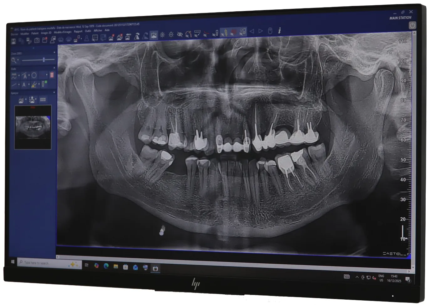 Radiographie dentaire panoramique 2D rapide et précise à Marrakech